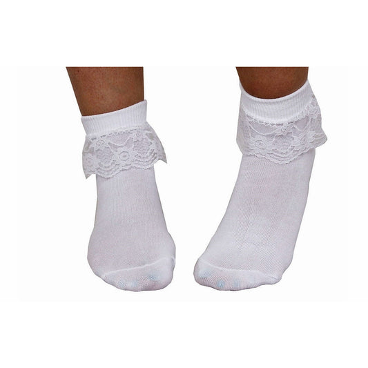 Girl's Short Socks with Lace Frill - Manchester Fancy Dress